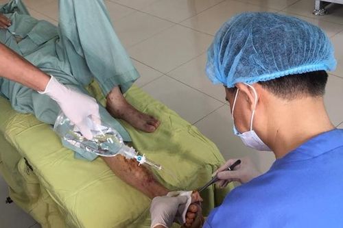 Biến chứng bàn chân do bệnh tiểu đường
