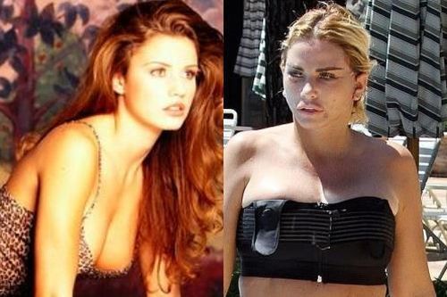 Katie Price - từ người mẫu nóng bỏng đến thảm họa thẩm mỹ