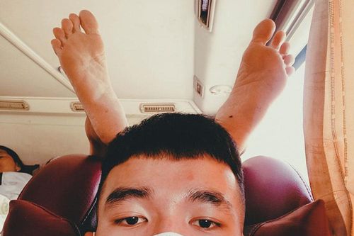 Bức ảnh bàn chân 'mọc' trên đầu chàng trai đi xe khách khiến nhiều người giật mình