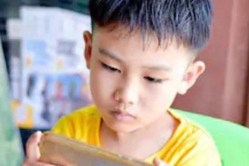 Cậu bé 10 tuổi bất ngờ bị... lác sau khi chơi điện thoại ròng rã 10 tiếng/ngày trong suốt kỳ nghỉ hè