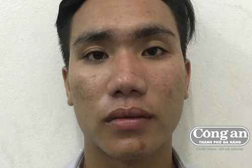Phanh gấp ra... dao!