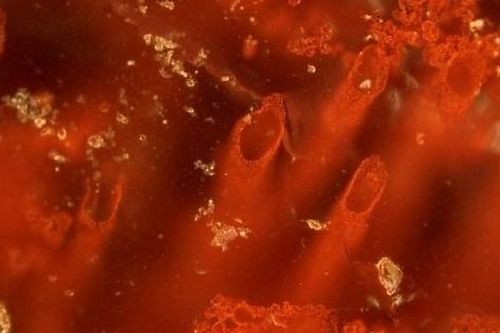 Vi sinh vật tìm thấy ở Kamchatka giúp điều trị khối u