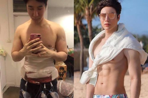 Nam giới châu Á sẵn sàng 'dao kéo' để tìm việc, kiếm người yêu?