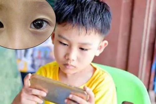 Con bị lác mắt, bố mẹ ân hận vì để con chơi điện thoại quá nhiều