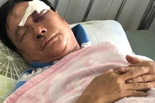 Con rể đánh bố vợ nhập viện cấp cứu