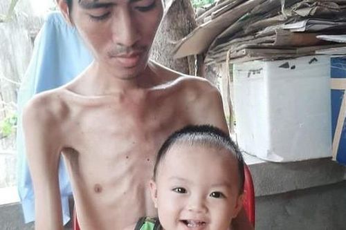 Đau xót cảnh người cha cố duy trì sự sống để chờ hiến thận cho con