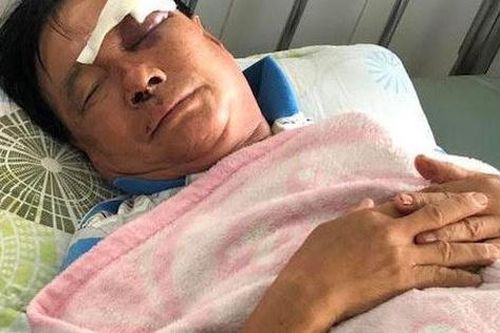 Mâu thuẫn việc tranh giành tài sản, con rể dùng chai bia đánh bố vợ nhập viện