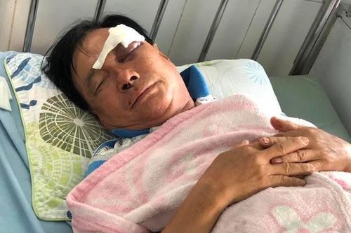 Con rể cầm chai bia đánh cha vợ bầm mắt phải cấp cứu