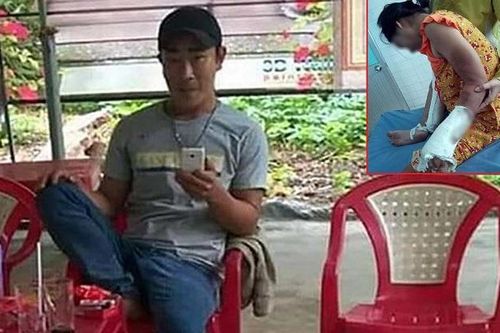 Chồng đánh đập tàn nhẫn vợ mang thai 7 tháng đến mức phải nhập viện cấp cứu