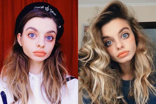 Dân mạng 'chia rẽ' vì cặp mắt 'to bất thường' của blogger Ukraine
