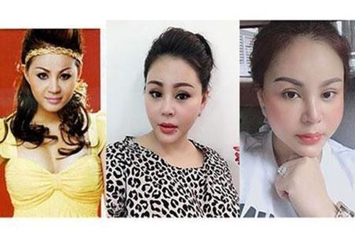 Sao Việt dao kéo đến biến dạng: Cơn nghiện thẩm mỹ bao giờ dừng