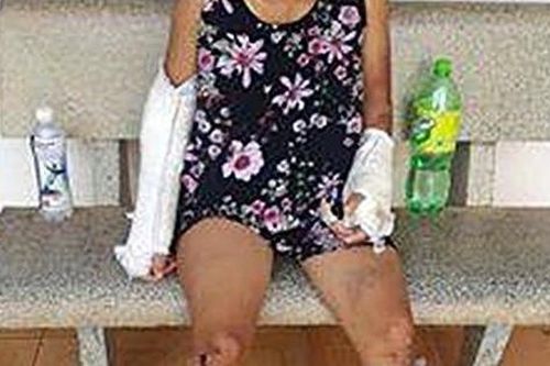 Sức khỏe thai phụ bị chồng đánh gãy tay chân bây giờ ra sao?