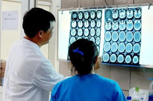 'Đập đá' thanh niên 27 tuổi ngộ độc, xuất huyết não