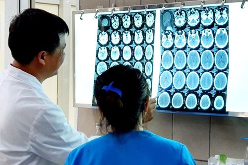Ngộ độc ma túy đá, một nam thanh niên bị xuất huyết não