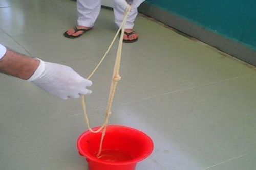 Kinh hãi sán xơ mít dài 7m kí sinh trong cơ thể người đàn ông ở Quảng Nam