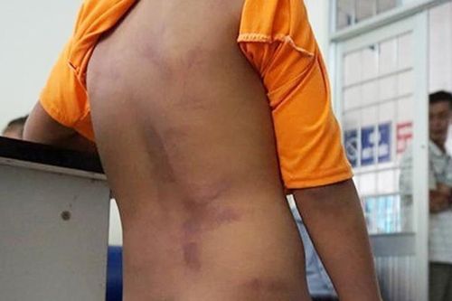 4 học sinh bị đánh 250 roi, xát muối ớt vào vết thương chưa thể đi học