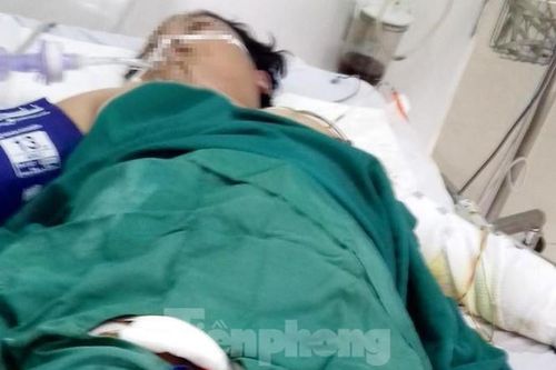 Chồng tưới xăng lên vợ mang bầu 8 tháng rồi châm lửa đốt