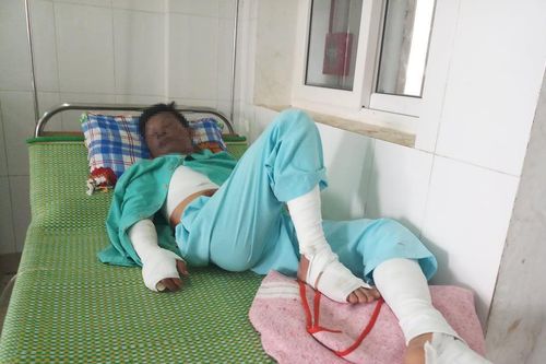 Vừa chơi game vừa sạc pin điện thoại, 1 thanh niên bị bỏng nặng