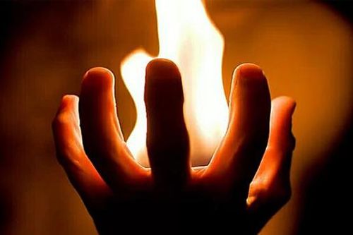 Bí ẩn câu chuyện bàn tay người tự bốc cháy, y học chưa có lời giải