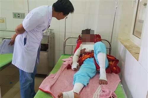 Điện thoại đang sạc pin phát nổ khiến nam thanh niên bị bỏng nặng