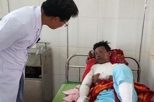 Điện thoại phát nổ trong lúc sạc pin, game thủ bỏng nặng
