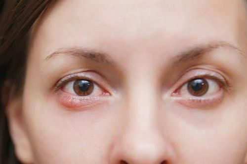 Nhiều người Việt bị mù vĩnh viễn do căn bệnh dễ bỏ qua