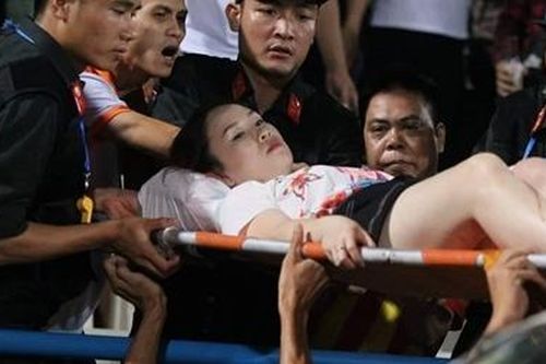 Nữ CĐV bị thương vì pháo sáng trên sân Hàng Đẫy