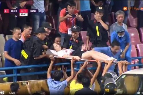 Nữ cổ động viên phải cấp cứu vì pháo sáng rơi trúng trên SVĐ Hàng Đẫy