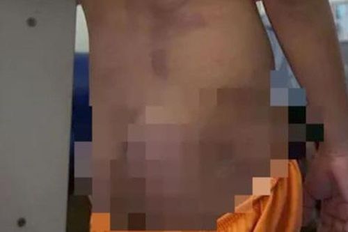 Không khởi tố vụ 4 cháu nhỏ bị bạo hành ở Cà Mau