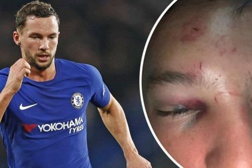 Sao Chelsea trả giá sau vụ tán tỉnh bạn gái đồng nghiệp