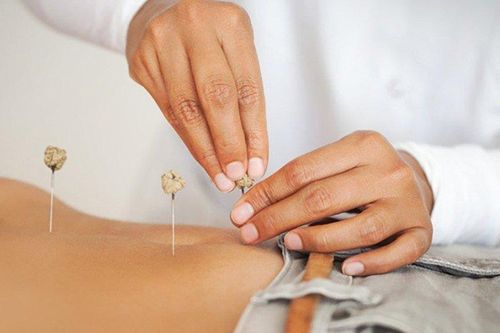 Đi châm cứu chữa bệnh, nữ bệnh nhân bị đâm thủng phổi