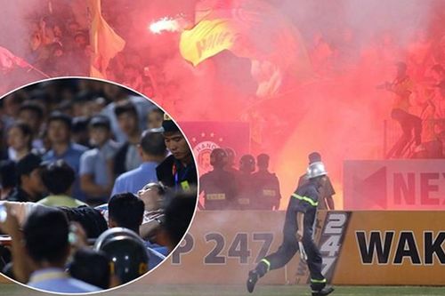 CĐV Nam Định bắn pháo sáng trúng fan nữ, CLB Hà Nội thất thu tiền khủng bao nhiêu?