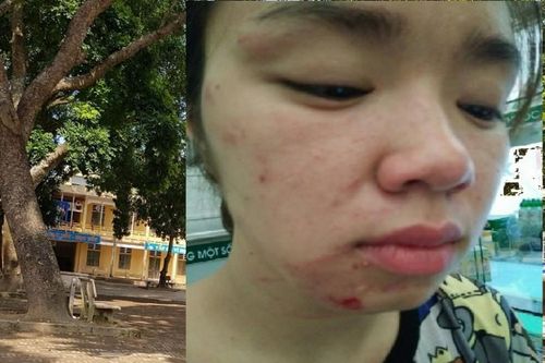 Một phụ nữ tố bị bố mẹ chồng cũ hành hung tại sân trường khi đón con