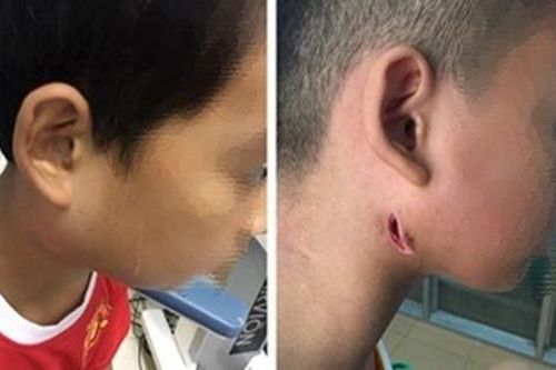 Phòng bệnh whitmore 'ăn thịt người': Người dân cần làm tốt những việc này