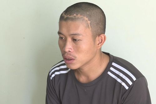 Tên cướp kéo lê người phụ nữ đeo vàng làm gãy tay nạn nhân