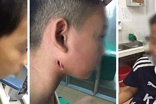 Cảnh giác và đối mặt với Whitmore