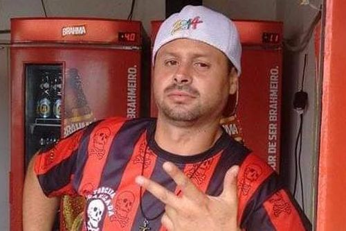 Cổ động viên Brazil bị cắt cụt bàn tay vì pháo sáng nổ