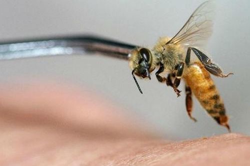 9 người nhập viện cấp cứu vì ong vò vẽ đốt