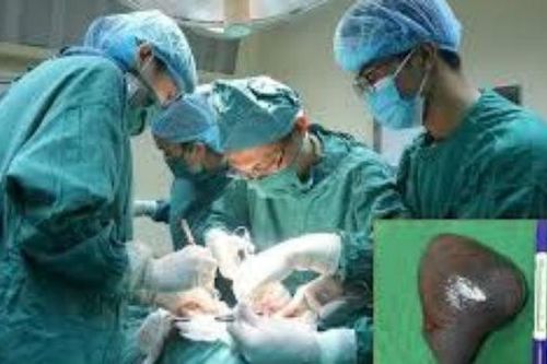 Gia tăng bệnh nhân ung thư lá lách