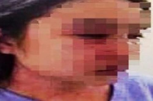 Bác sỹ nghi đánh nữ điều dưỡng ở Huế có bị xử lý hình sự?