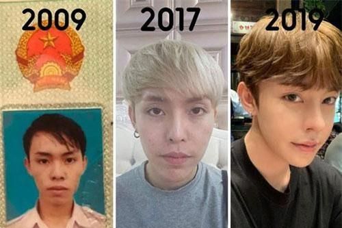 Chàng trai Đà Nẵng phẫu thuật thẩm mỹ 9 lần trong 10 năm