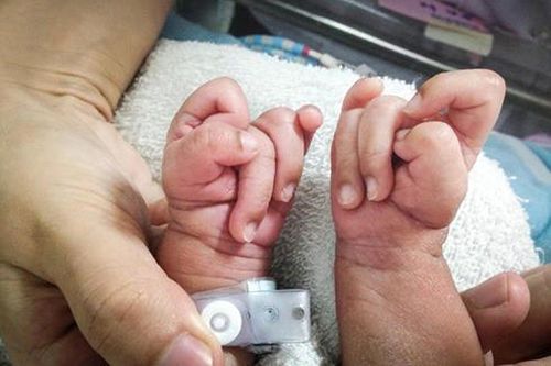 Dị tật bẩm sinh ở trẻ: Nỗi trăn trở của bậc làm cha mẹ