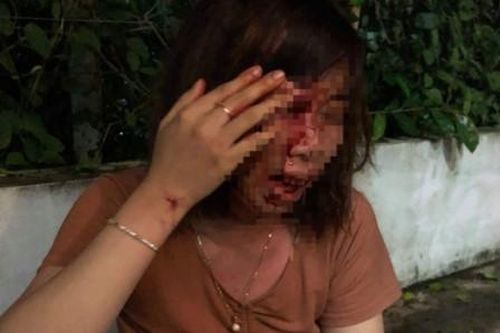 Người mẹ mang thai 4 tháng bị hàng xóm đánh nhập viện