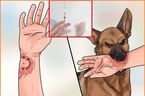 Bệnh dại: Mối nguy hại cho cả người và vật nuôi