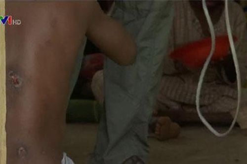 400 người bị tra tấn trong một căn nhà ở Nigeria