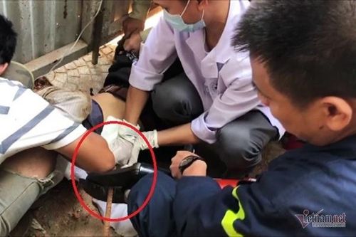 Nam công nhân bị thanh sắt dài gần 4m rơi đâm xuyên bụng