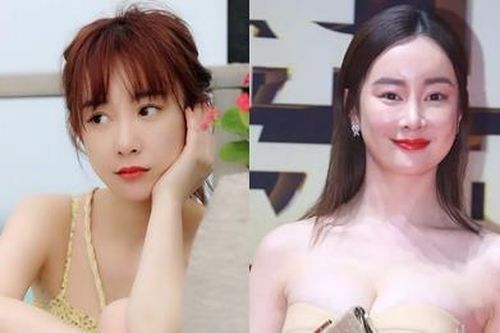'Thảm họa thẩm mỹ' Trương Mông lấy lại nhan sắc