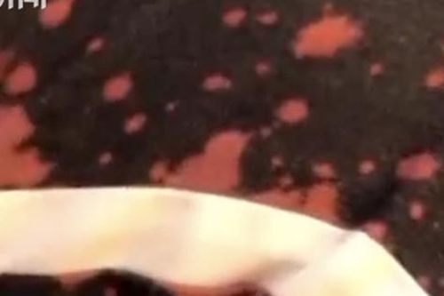 Đến nhà hàng ăn cùng mẹ, chàng trai gọi nước suối uống rồi đột ngột phun ra và nôn mửa, hóa ra đã uống nhầm thuốc tẩy