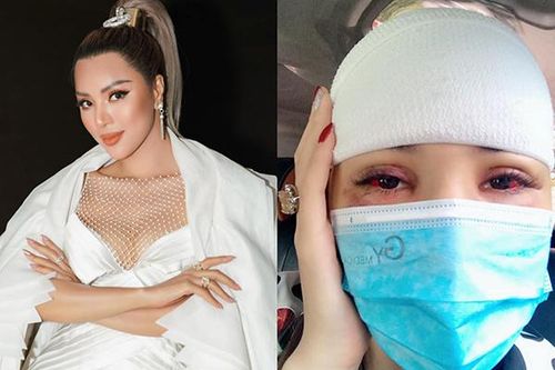 Bị kệ rơi trúng đầu, siêu mẫu Khả Trang phải khâu 10 mũi