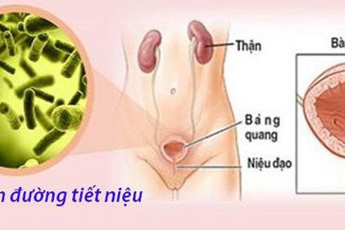Viêm đường tiết niệu tái phát nhiều người chủ quan nhưng không lường trước được hậu quả đáng sợ thế nào